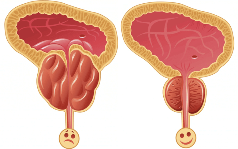 មូលហេតុនៃបញ្ហាថាមពលចំពោះបុរស